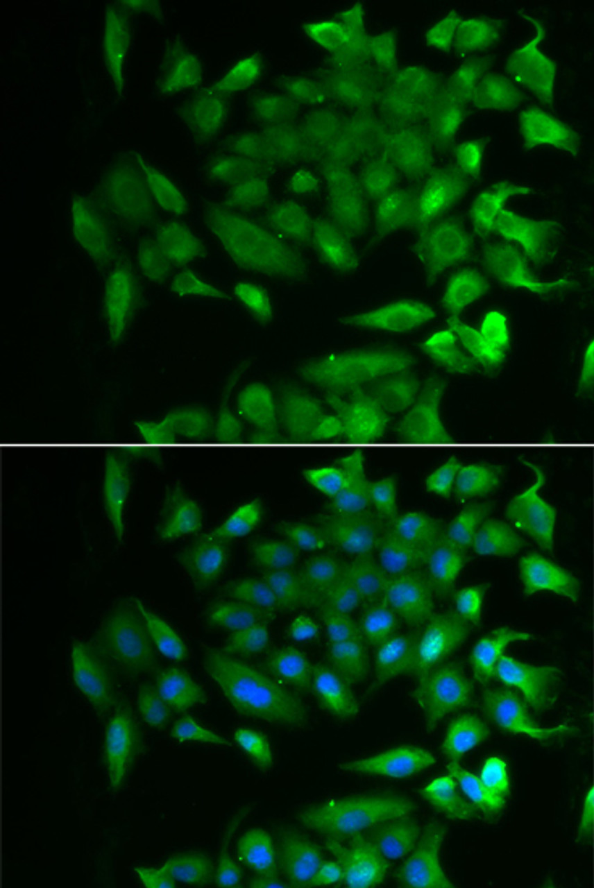 Immunofluorescence analysis of MCF-7 cells using RBP2 Polyclonal Antibody