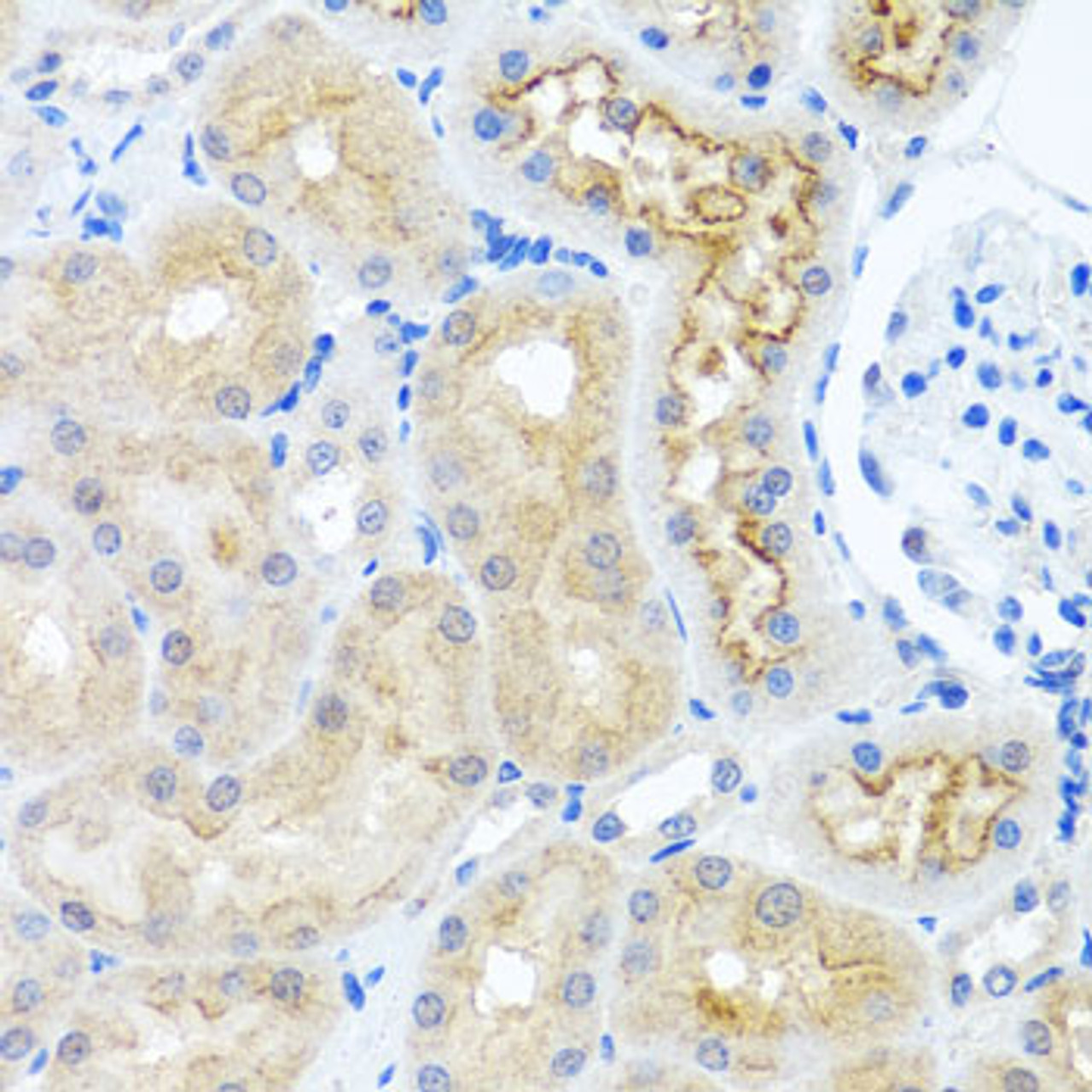 Immunohistochemistry of paraffin-embedded Rat kidney using RPS2 Polyclonal Antibody at dilution of  1:100 (40x lens).