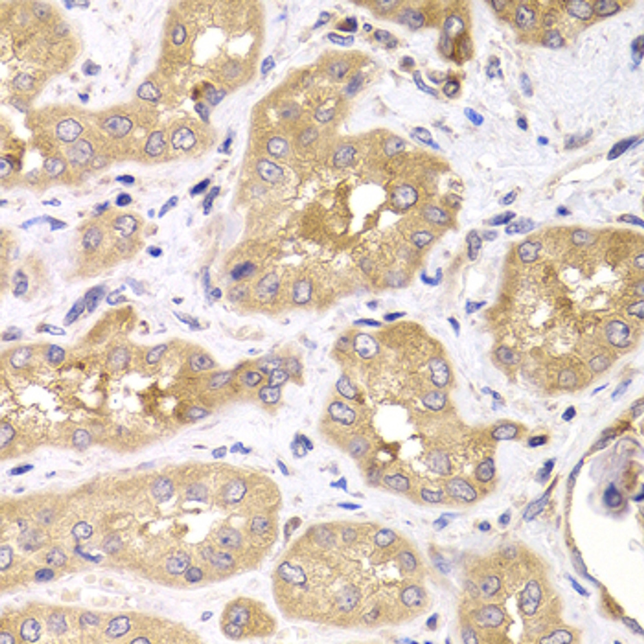 Immunohistochemistry of paraffin-embedded Human kidney using RPS4X Polyclonal Antibody at dilution of  1:100 (40x lens).