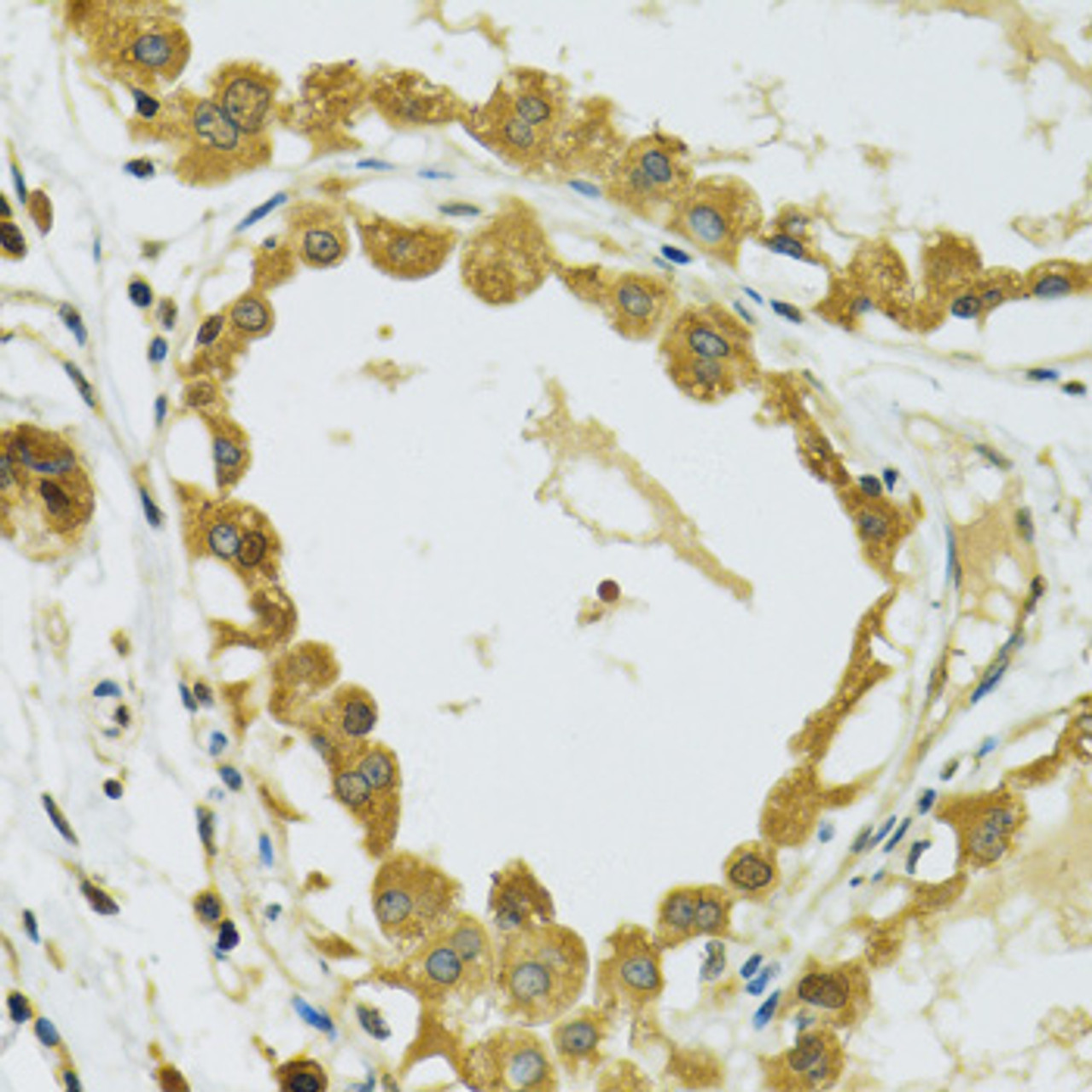Immunohistochemistry of paraffin-embedded Human breast using RPS7 Polyclonal Antibody at dilution of  1:100 (40x lens).