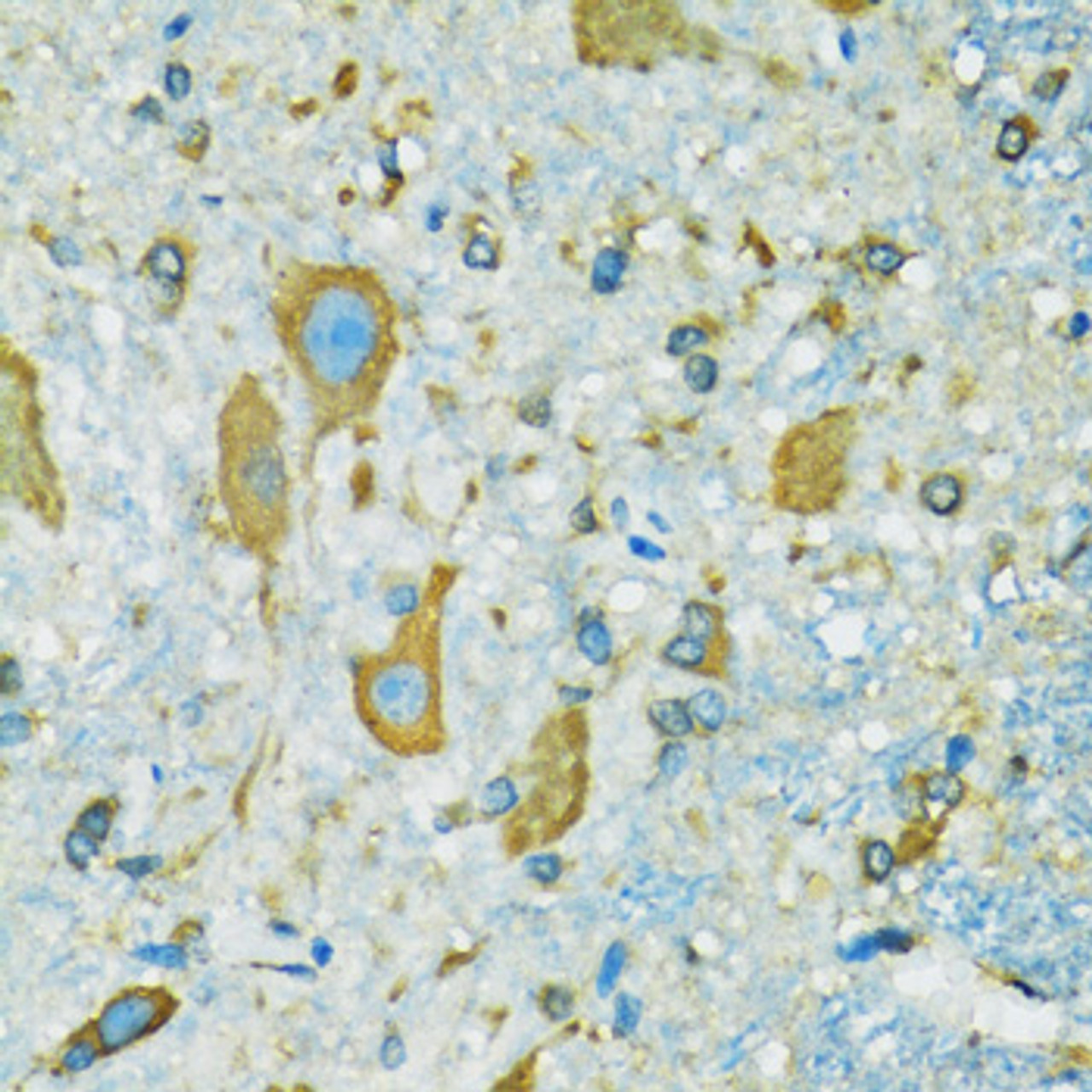 Immunohistochemistry of paraffin-embedded Mouse spinal cord using RPS7 Polyclonal Antibody at dilution of  1:100 (40x lens).