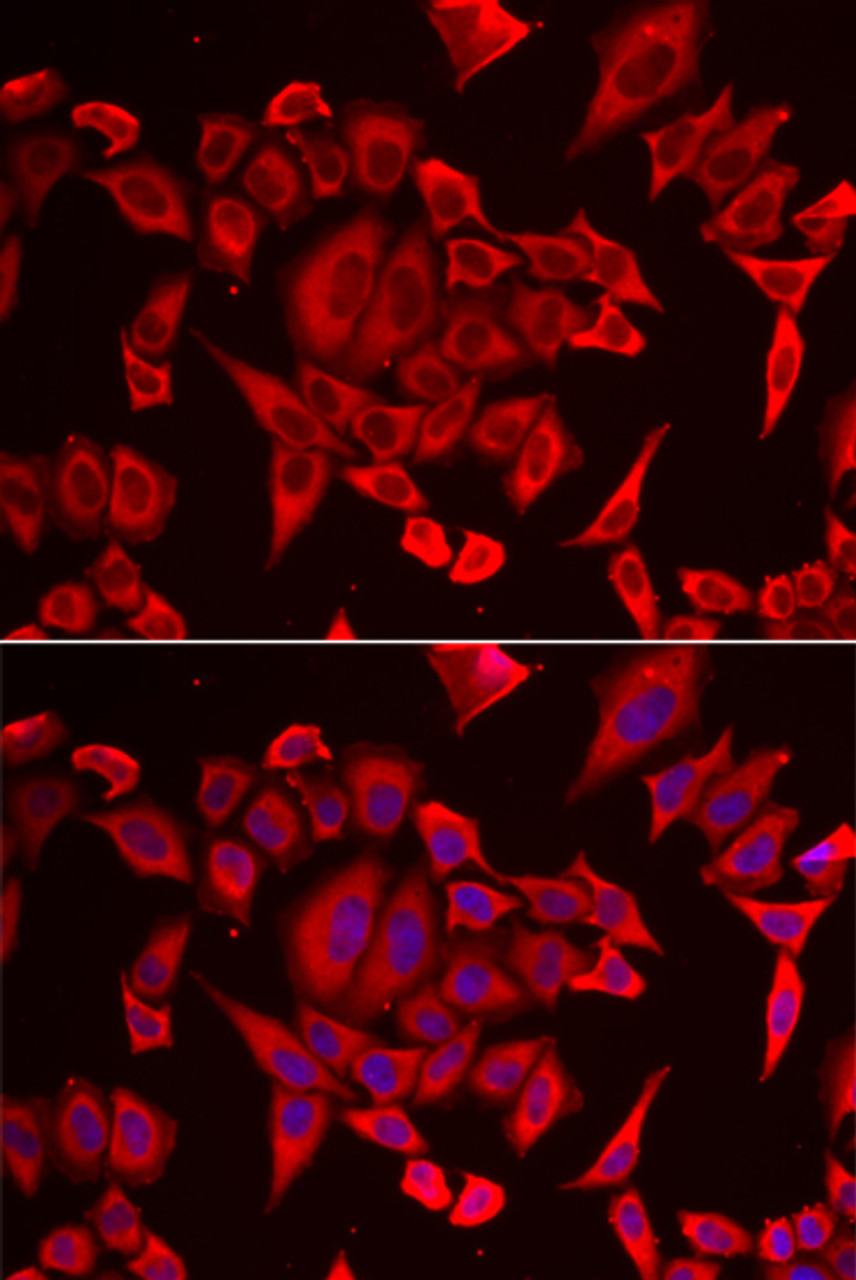Immunofluorescence analysis of HeLa cells using SLC20A2 Polyclonal Antibody