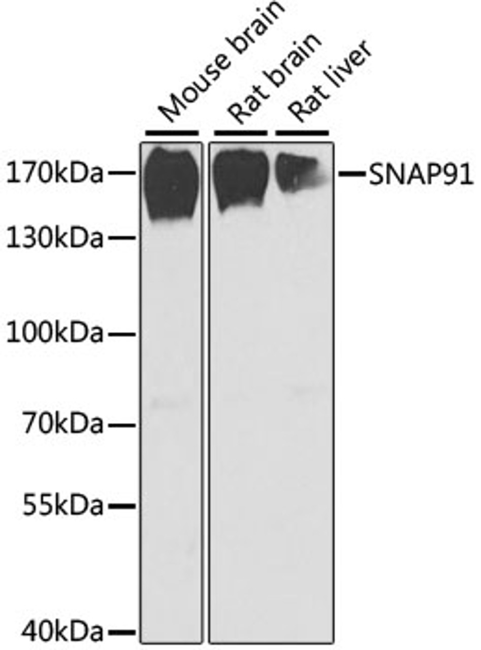 Western blot analysis of extracts of various cell lines using SNAP91 Polyclonal Antibody at dilution of 1:1000.