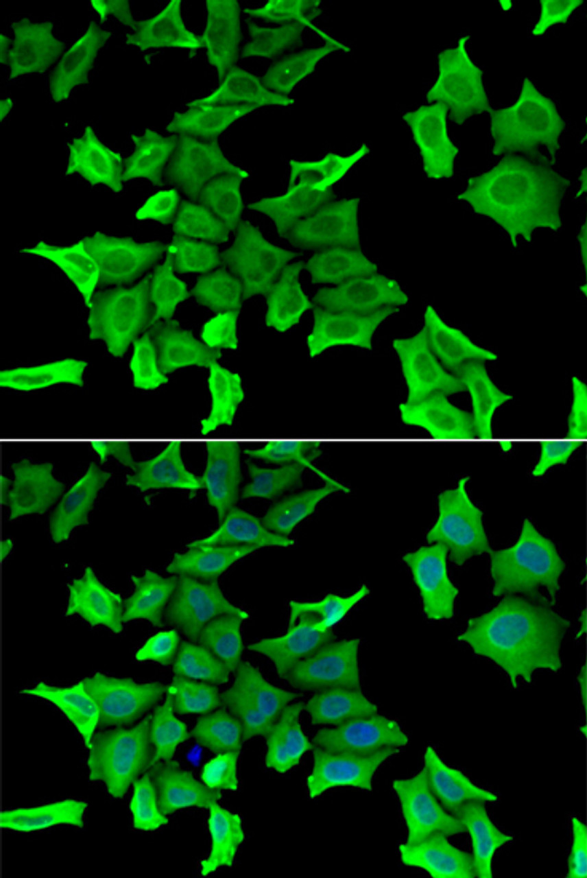 Immunofluorescence analysis of HeLa cells using SPINT2 Polyclonal Antibody