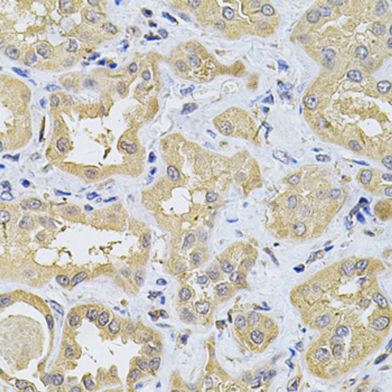 Immunohistochemistry of paraffin-embedded Human kidney using SPTLC1 Polyclonal Antibody at dilution of  1:100 (40x lens).