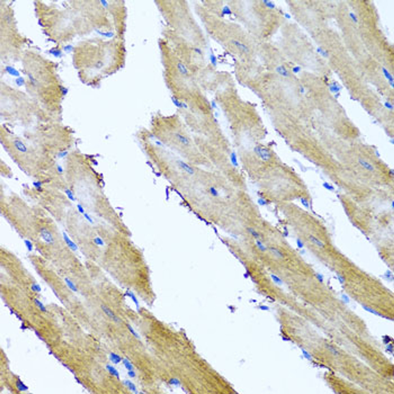 Immunohistochemistry of paraffin-embedded Rat heart using SRI Polyclonal Antibody at dilution of  1:100 (40x lens).