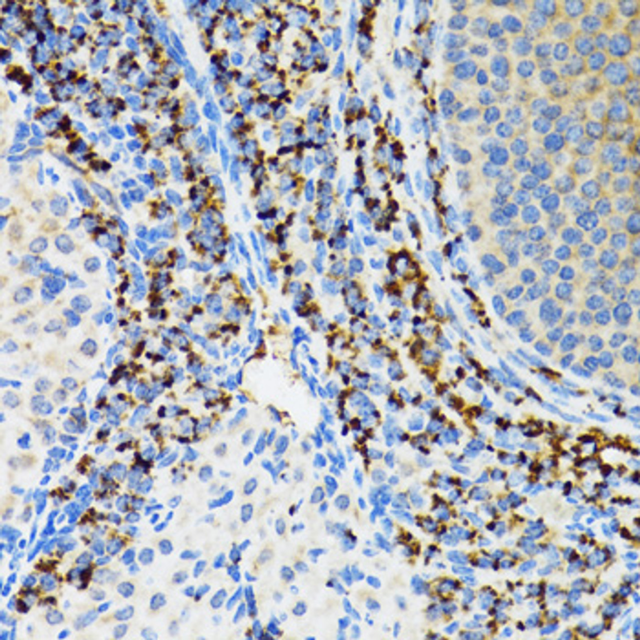 Immunohistochemistry of paraffin-embedded Rat ovary using SRP19 Polyclonal Antibody at dilution of  1:100 (40x lens).