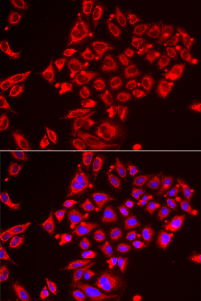 Immunofluorescence analysis of HeLa cells using ST3GAL3 Polyclonal Antibody