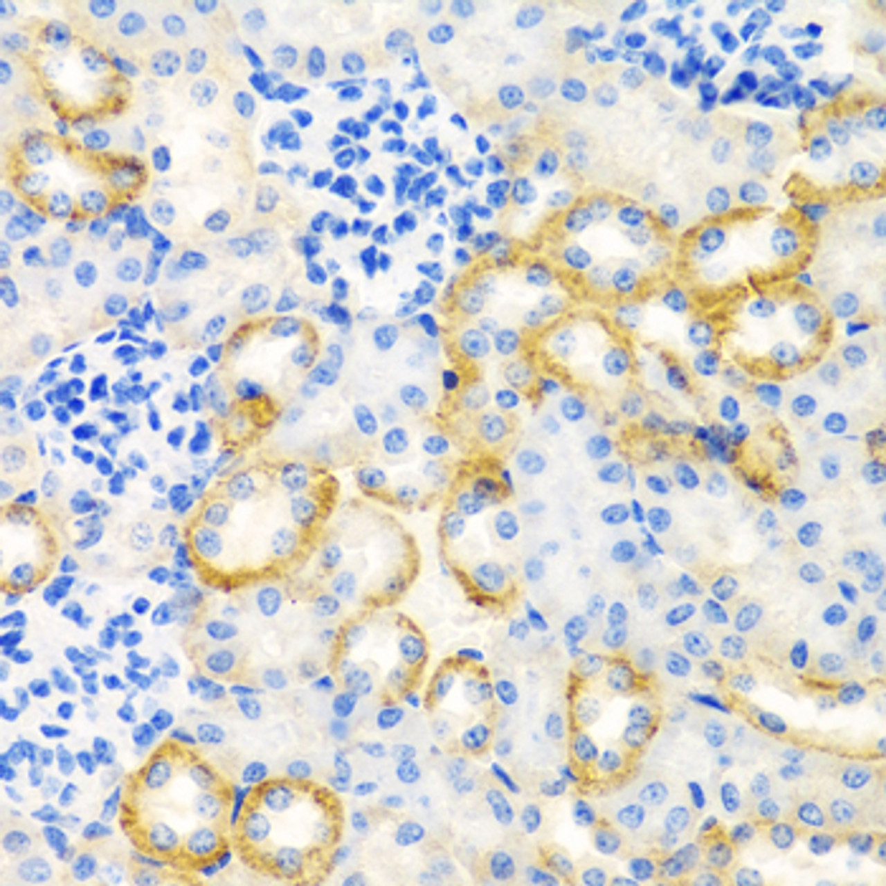 Immunohistochemistry of paraffin-embedded Rat kidney using STC1 Polyclonal Antibody at dilution of  1:100 (40x lens).