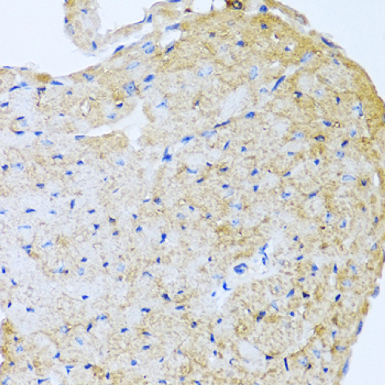 Immunohistochemistry of paraffin-embedded Mouse heart using STC1 Polyclonal Antibody at dilution of  1:100 (40x lens).