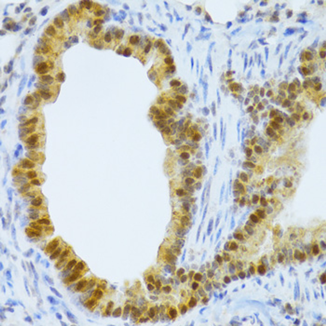 Immunohistochemistry of paraffin-embedded Mouse lung using TAF1C Polyclonal Antibody at dilution of  1:100 (40x lens).