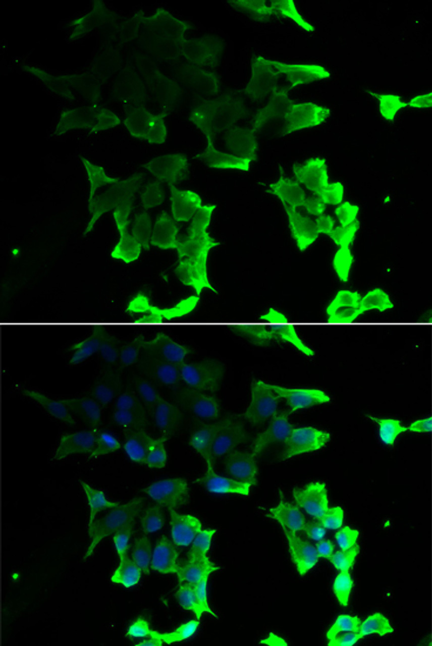 Immunofluorescence analysis of HeLa cells using TANK Polyclonal Antibody