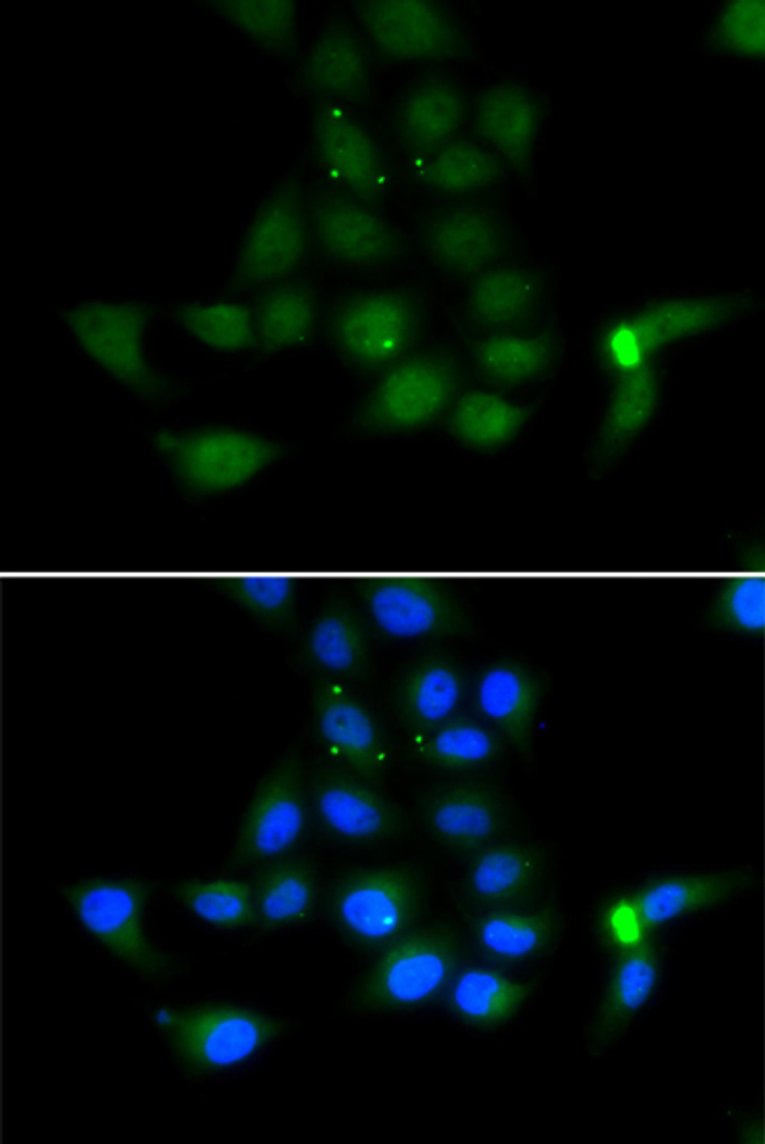 Immunofluorescence analysis of MCF-7 cells using TAT Polyclonal Antibody