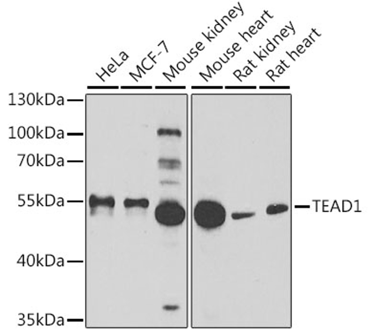 Western blot analysis of extracts of various cell lines using TEAD1 Polyclonal Antibody at dilution of 1:1000.