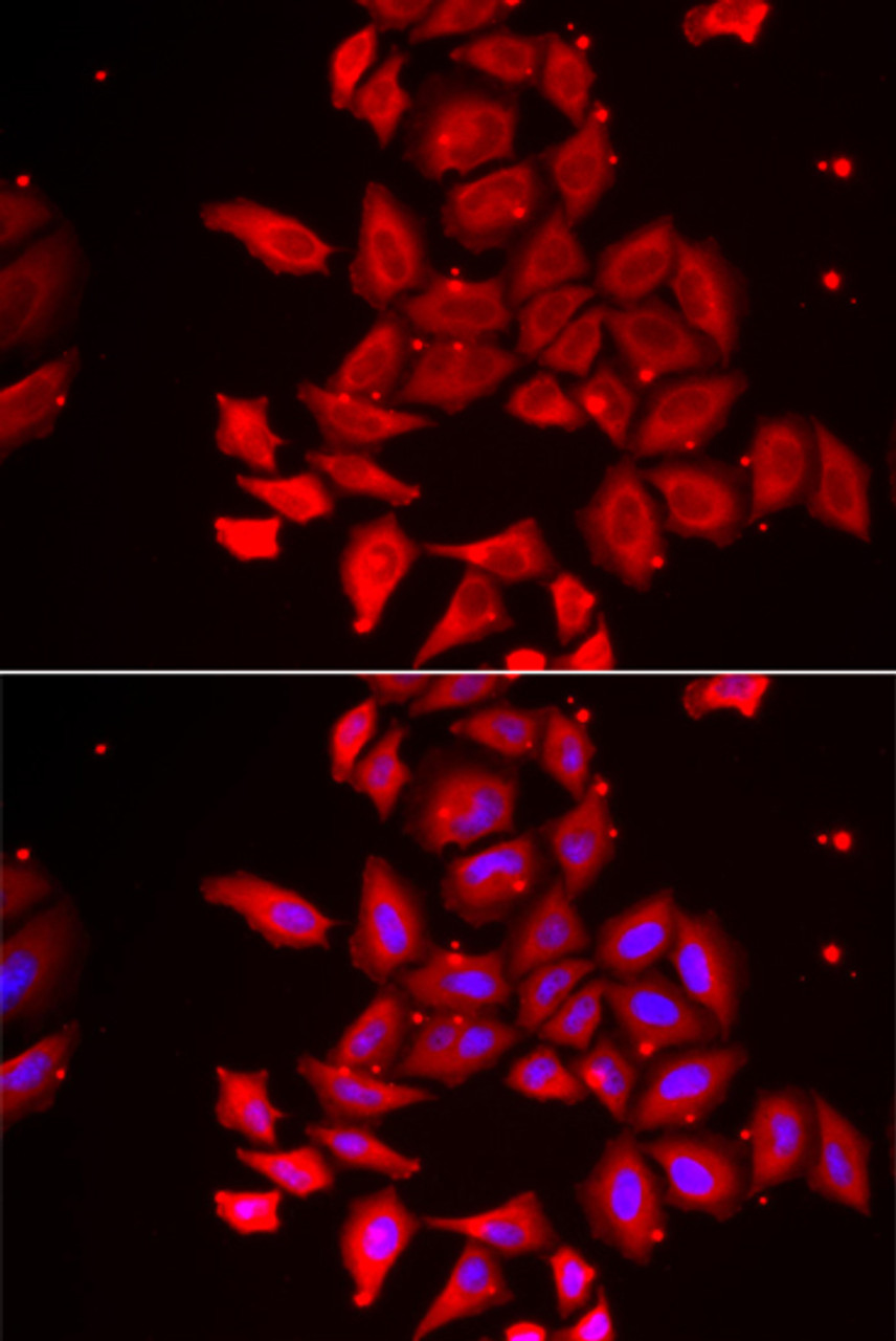 Immunofluorescence analysis of U2OS cells using TMOD4 Polyclonal Antibody