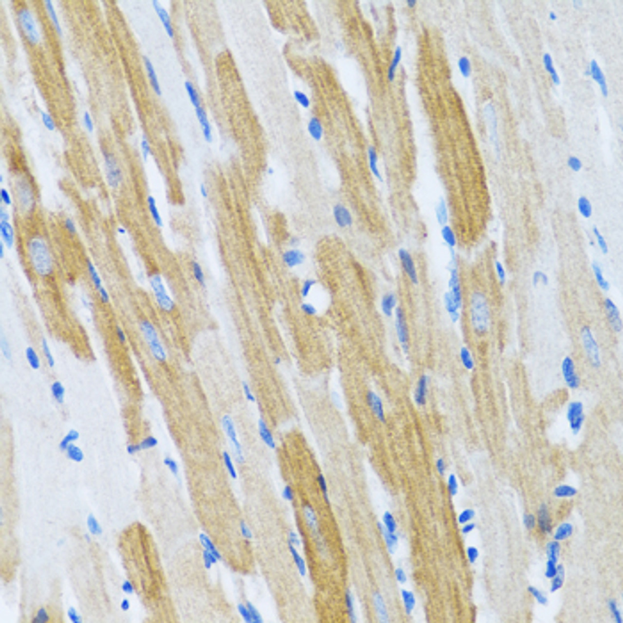 Immunohistochemistry of paraffin-embedded Rat heart using WFDC2 Polyclonal Antibody at dilution of  1:100 (40x lens).