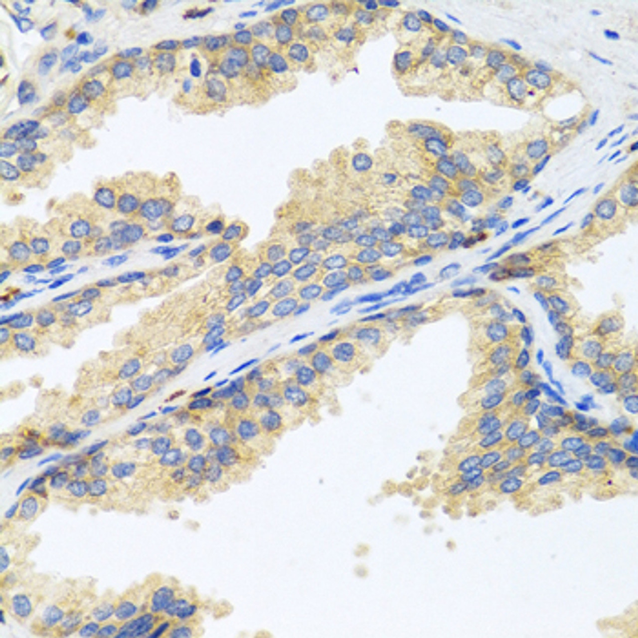Immunohistochemistry of paraffin-embedded Human prostate using WFDC2 Polyclonal Antibody at dilution of  1:100 (40x lens).