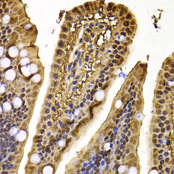 Immunohistochemistry of paraffin-embedded Mouse jejunum using XPO5 Polyclonal Antibody at dilution of  1:100 (40x lens).