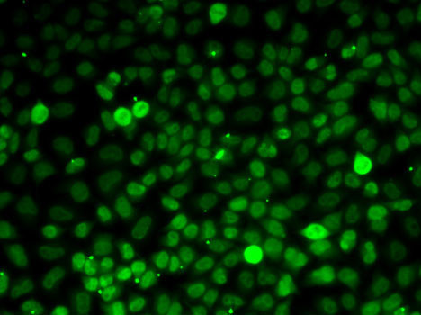 Immunofluorescence analysis of MCF7 cells using XPO5 Polyclonal Antibody