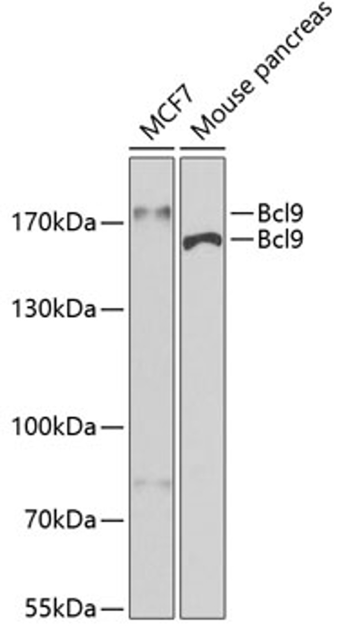 Western blot analysis of extracts of various cell lines using Bcl9 Polyclonal Antibody at dilution of 1:400.