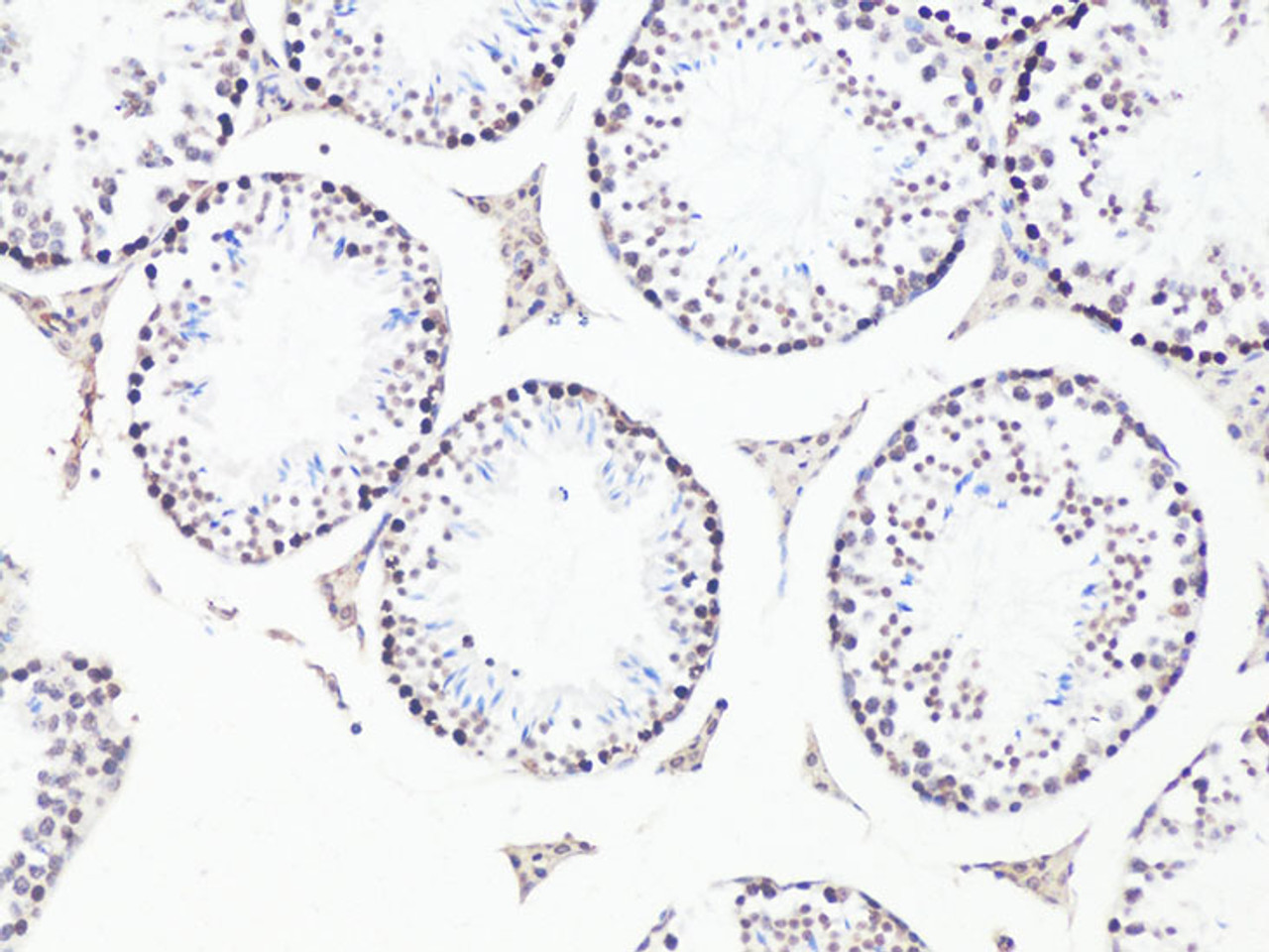 Immunohistochemistry of paraffin-embedded Mouse testis using Bcl9 Polyclonal Antibody at dilution of  1:100 (20x lens).