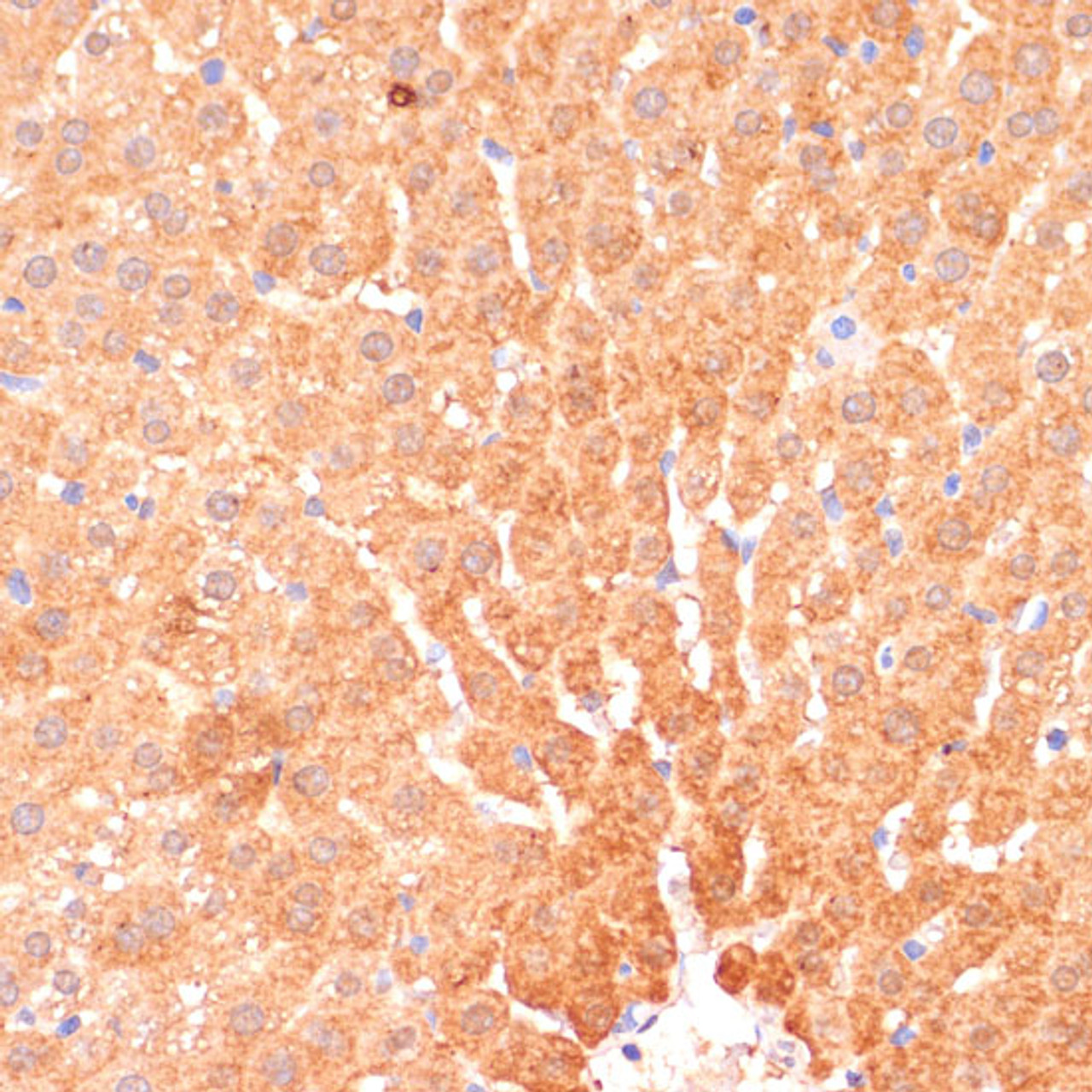 Immunohistochemistry of paraffin-embedded Rat liver using CPT1B Polyclonal Antibody at dilution of  1:100 (40x lens).