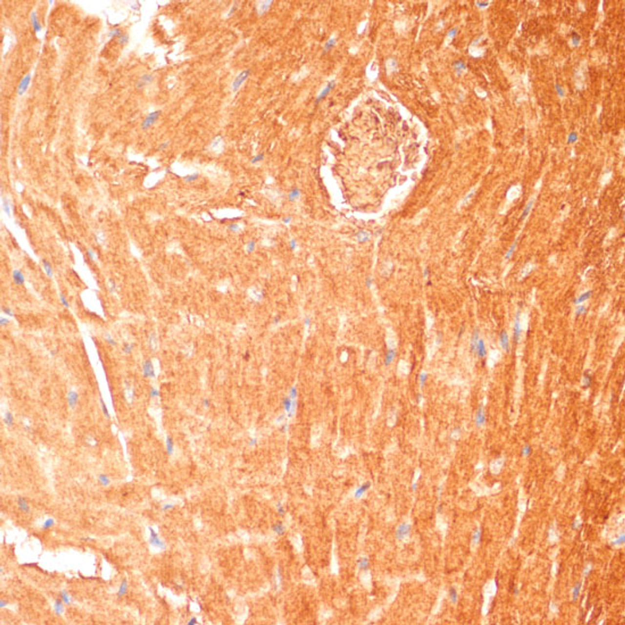 Immunohistochemistry of paraffin-embedded Mouse heart using CPT1B Polyclonal Antibody at dilution of  1:100 (40x lens).