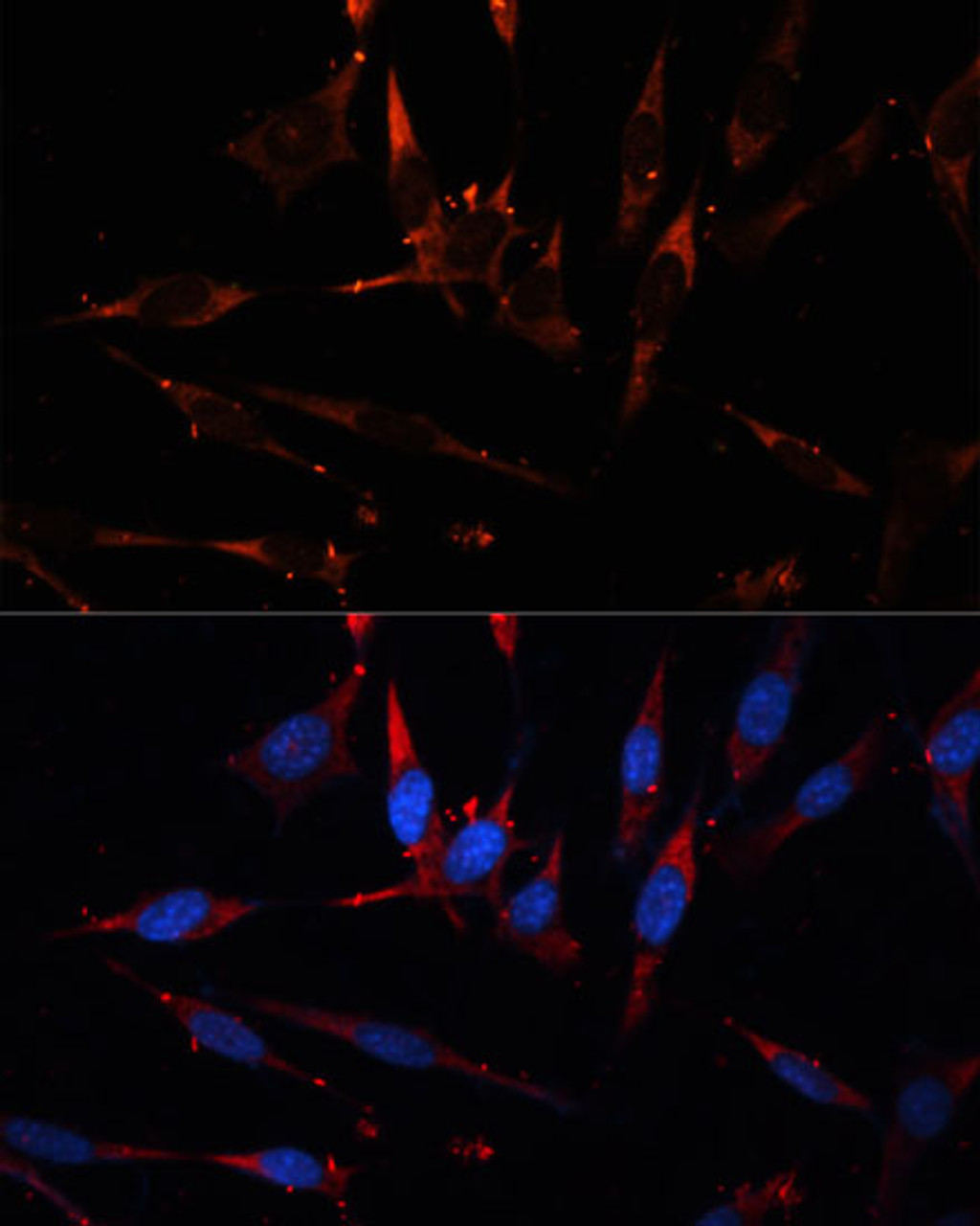 Immunofluorescence analysis of NIH/3T3 cells using CPT1B Polyclonal Antibody at dilution of  1:100. Blue: DAPI for nuclear staining.