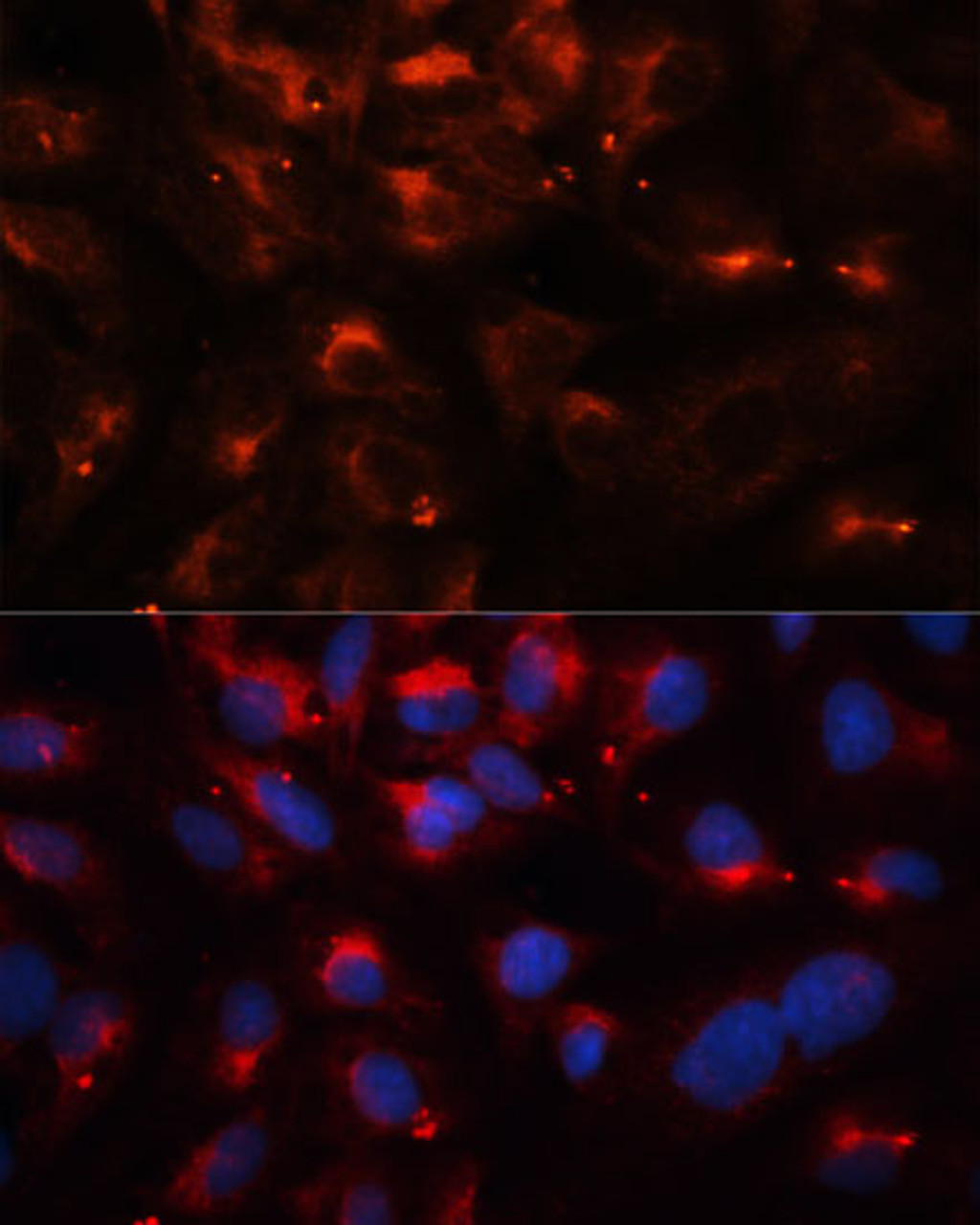 Immunofluorescence analysis of U2OS cells using CPT1B Polyclonal Antibody at dilution of  1:100. Blue: DAPI for nuclear staining.