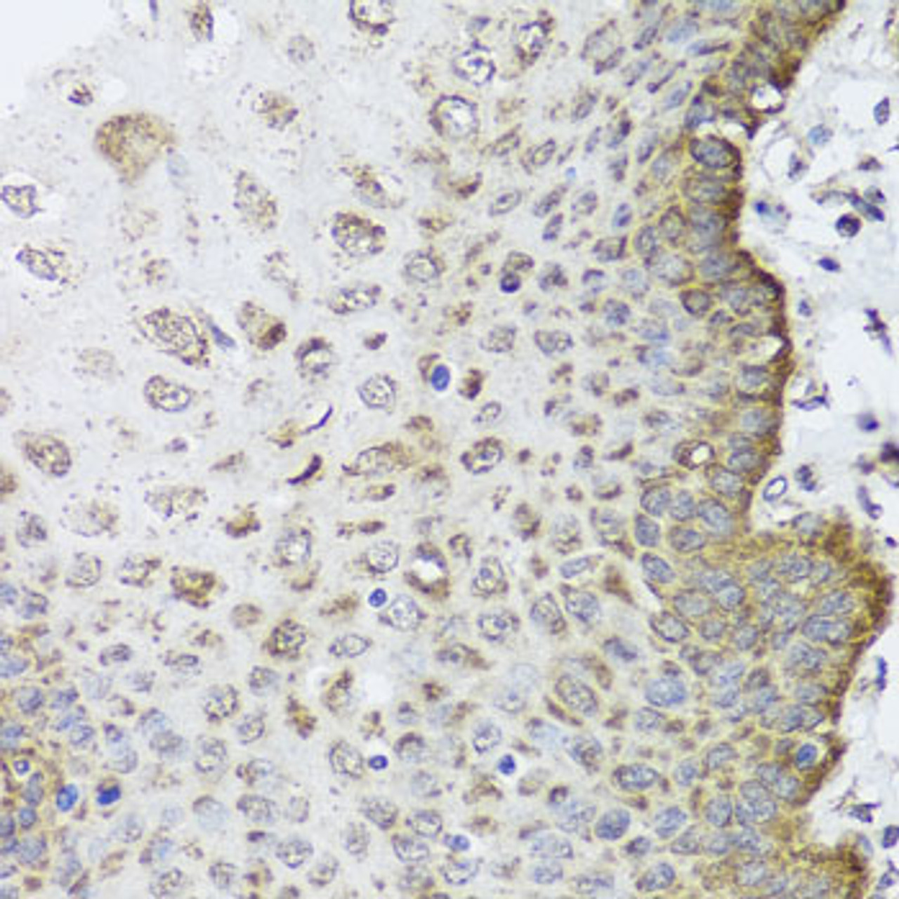 Immunohistochemistry of paraffin-embedded Human esophagus using FANCL Polyclonal Antibody at dilution of  1:100 (40x lens).