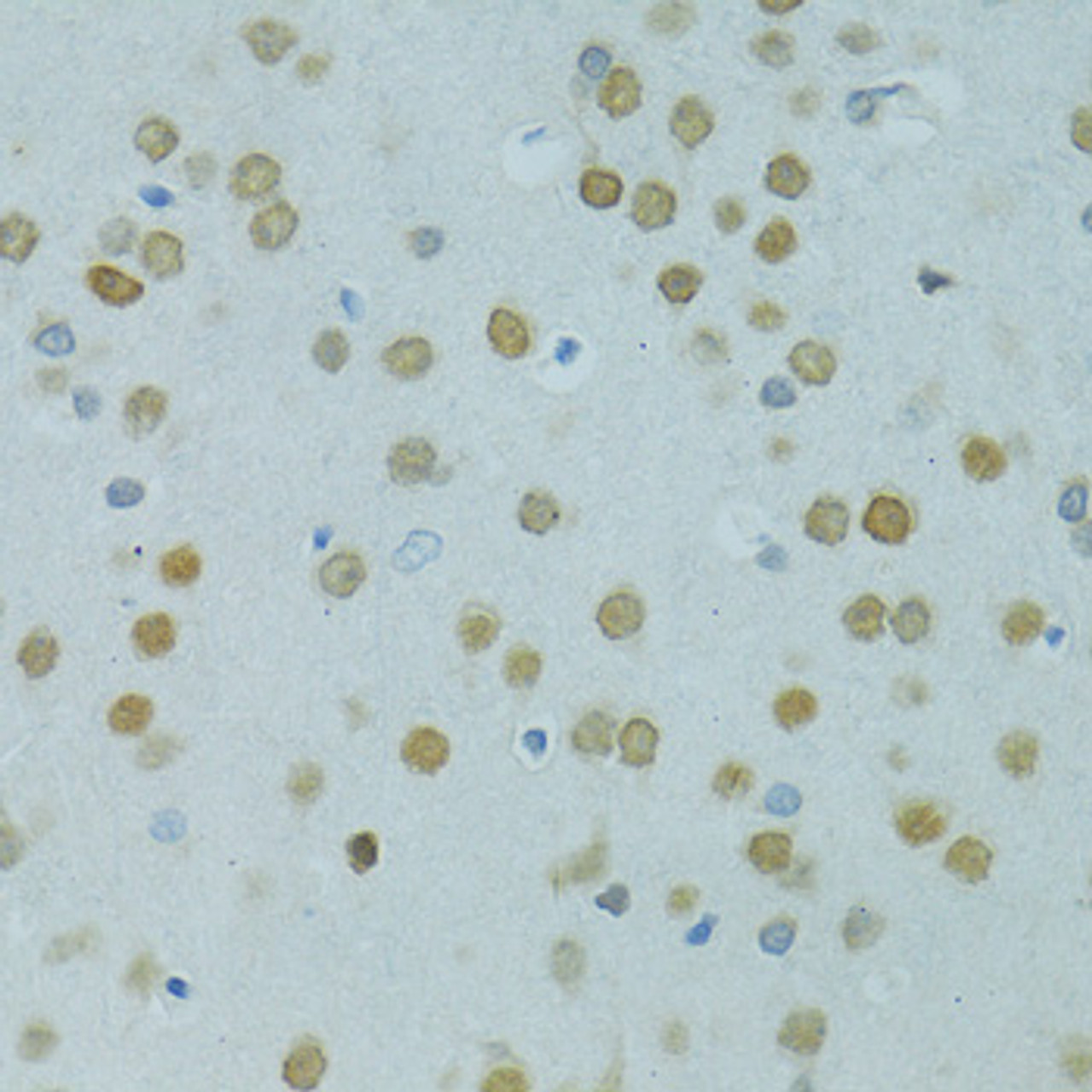 Immunohistochemistry of paraffin-embedded Rat brain using MUS81 Polyclonal Antibody at dilution of  1:100 (40x lens).
