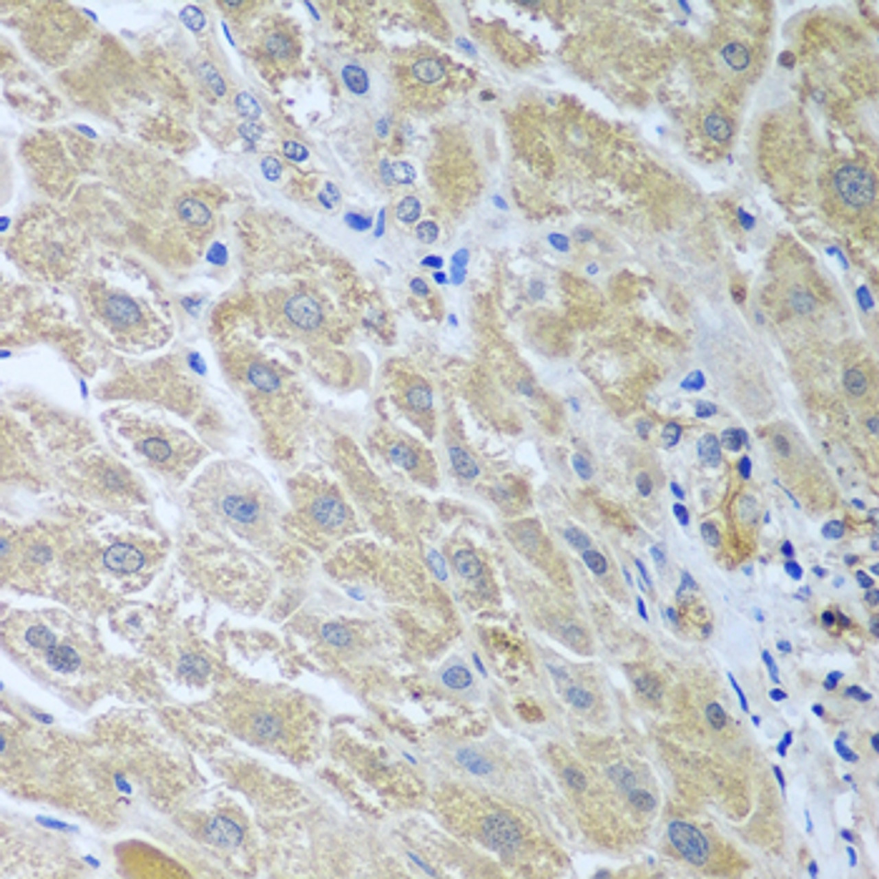 Immunohistochemistry of paraffin-embedded Human liver using WDR48 Polyclonal Antibody at dilution of  1:100 (40x lens).