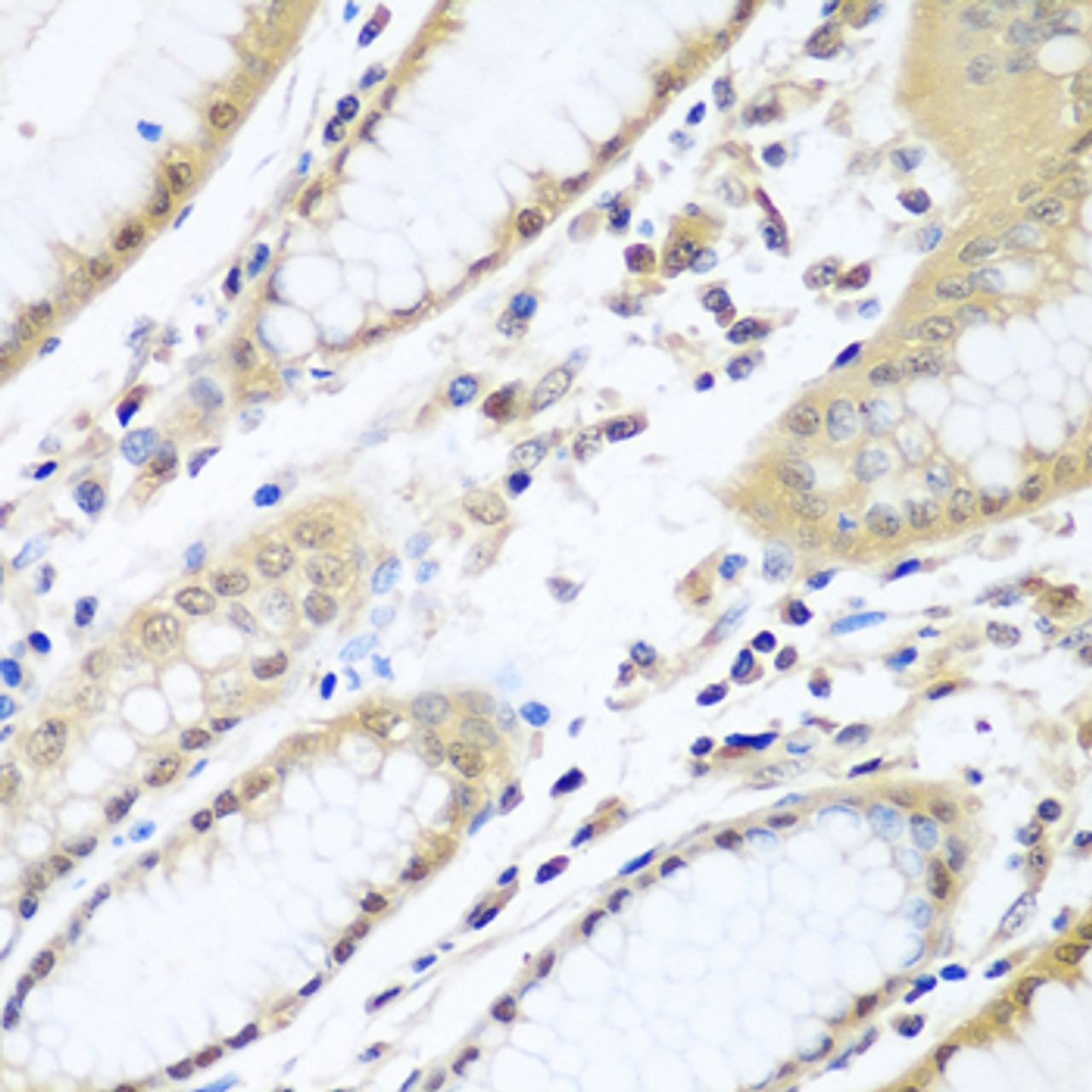 Immunohistochemistry of paraffin-embedded Human stomach using WDR48 Polyclonal Antibody at dilution of  1:100 (40x lens).