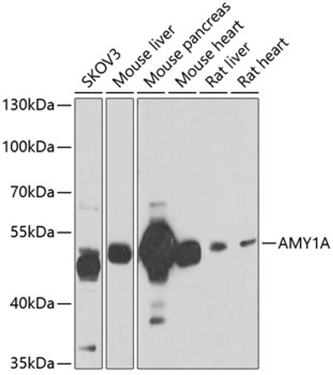 Western blot analysis of extracts of various cell lines using AMY1A Polyclonal Antibody at dilution of 1:1000.