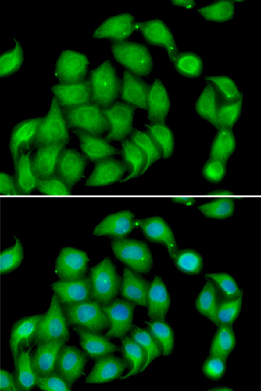 Immunofluorescence analysis of HeLa cells using ASPH Polyclonal Antibody