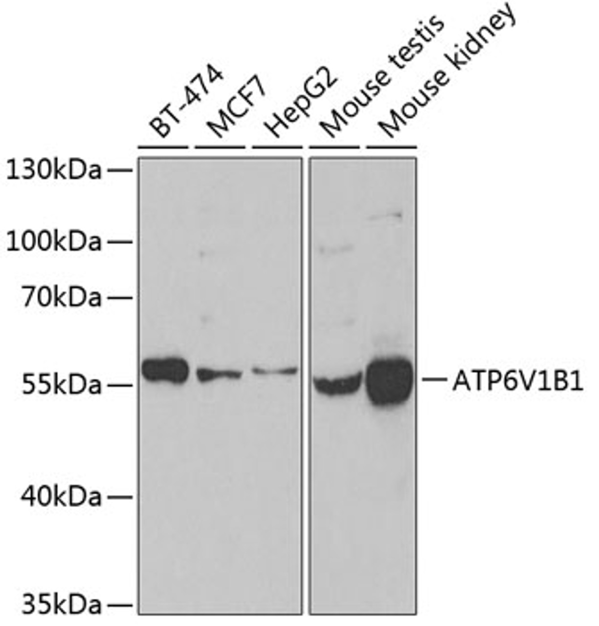 Western blot analysis of extracts of various cell lines using ATP6V1B1 Polyclonal Antibody at dilution of 1:1000.