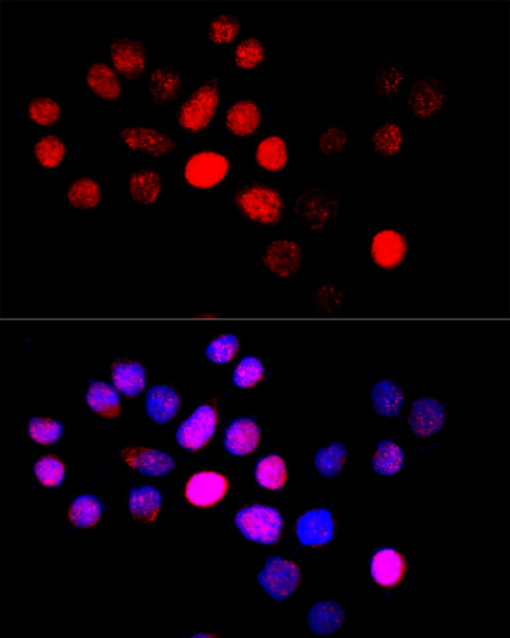 Immunofluorescence analysis of HeLa cells using CYP4B1 Polyclonal Antibody at dilution of  1:100 (40x lens). Blue: DAPI for nuclear staining.
