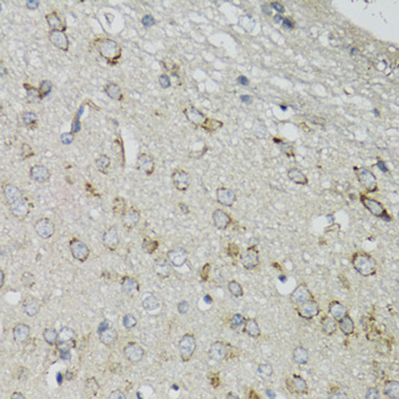 Immunohistochemistry of paraffin-embedded Mouse brain using DGUOK Polyclonal Antibody at dilution of  1:100 (40x lens).