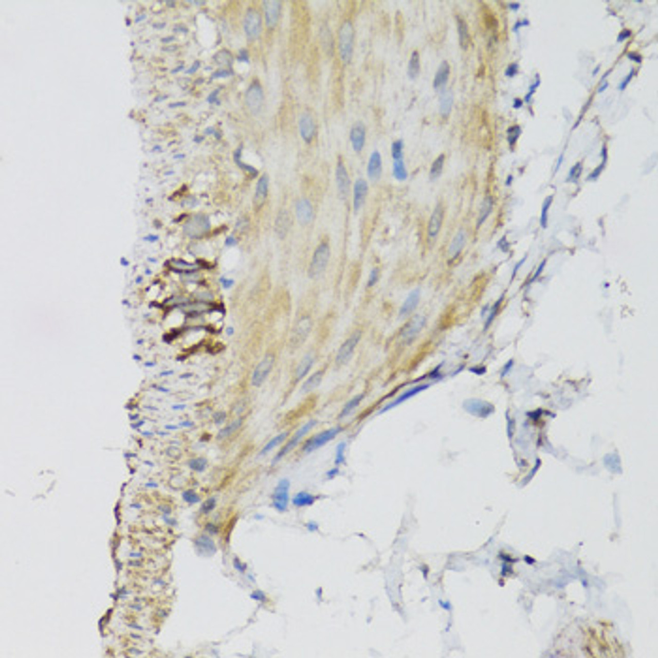 Immunohistochemistry of paraffin-embedded Mouse stomach using DGUOK Polyclonal Antibody at dilution of  1:100 (40x lens).