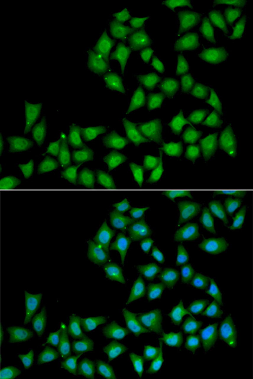 Immunofluorescence analysis of A549 cells using ELF1 Polyclonal Antibody