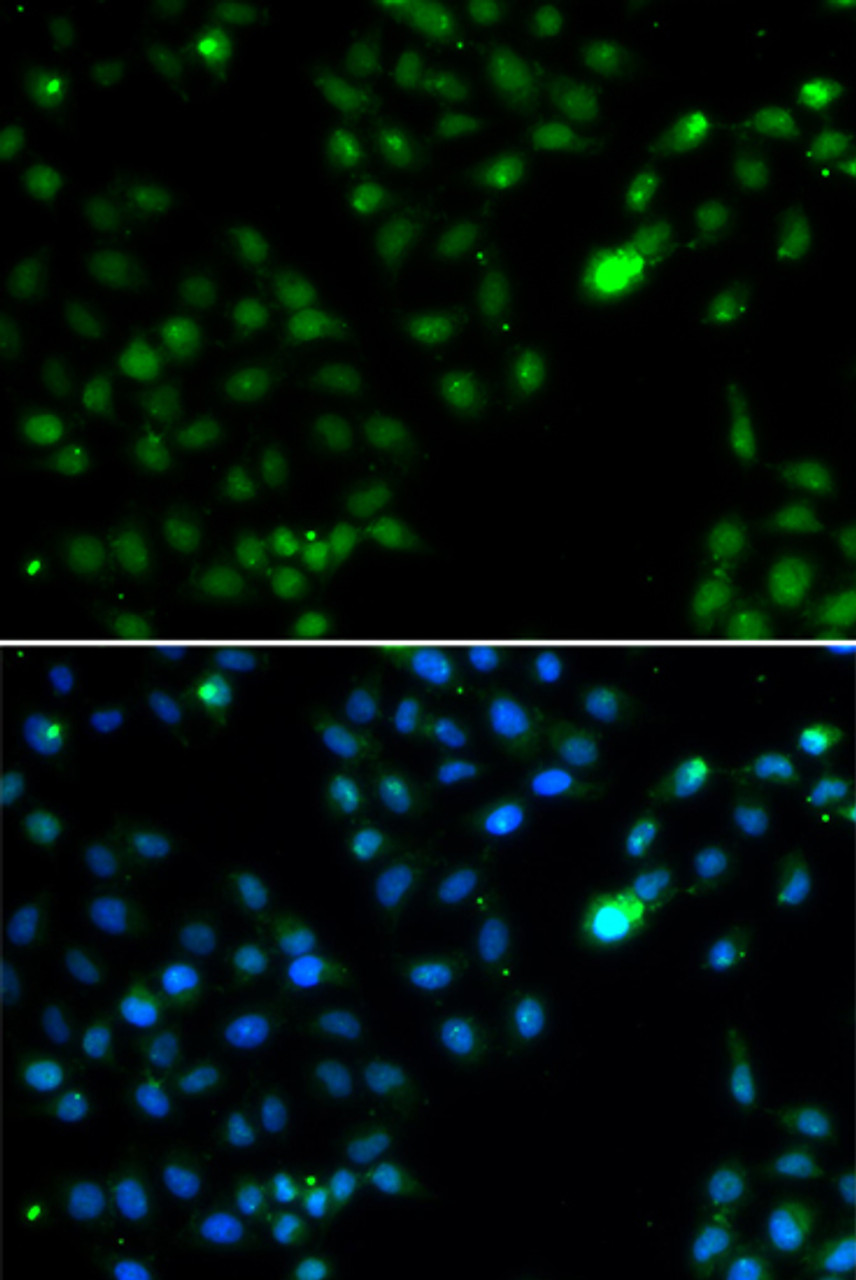 Immunofluorescence analysis of HeLa cells using FKBP3 Polyclonal Antibody