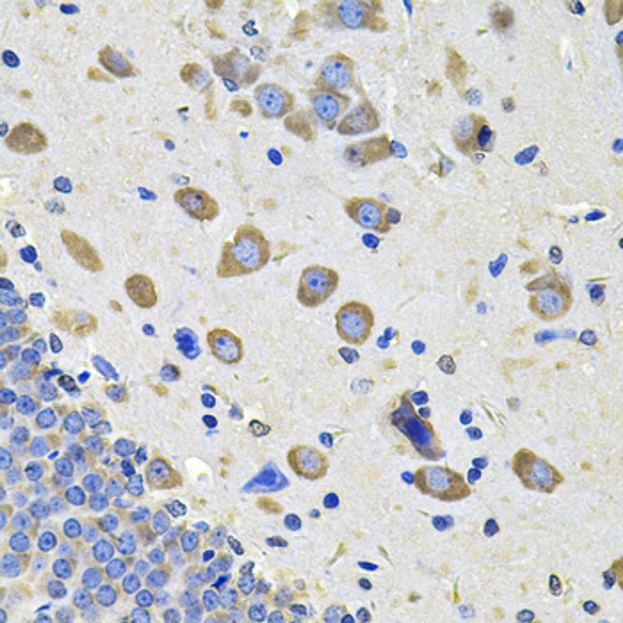 Immunohistochemistry of paraffin-embedded Rat brain using GALNT2 Polyclonal Antibody at dilution of  1:100 (40x lens).