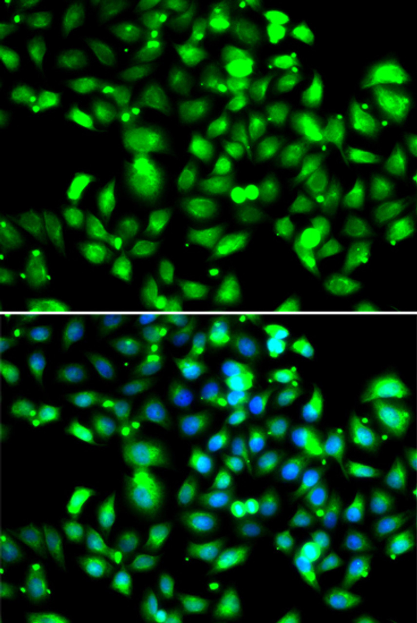 Immunofluorescence analysis of U2OS cells using GBP1 Polyclonal Antibody