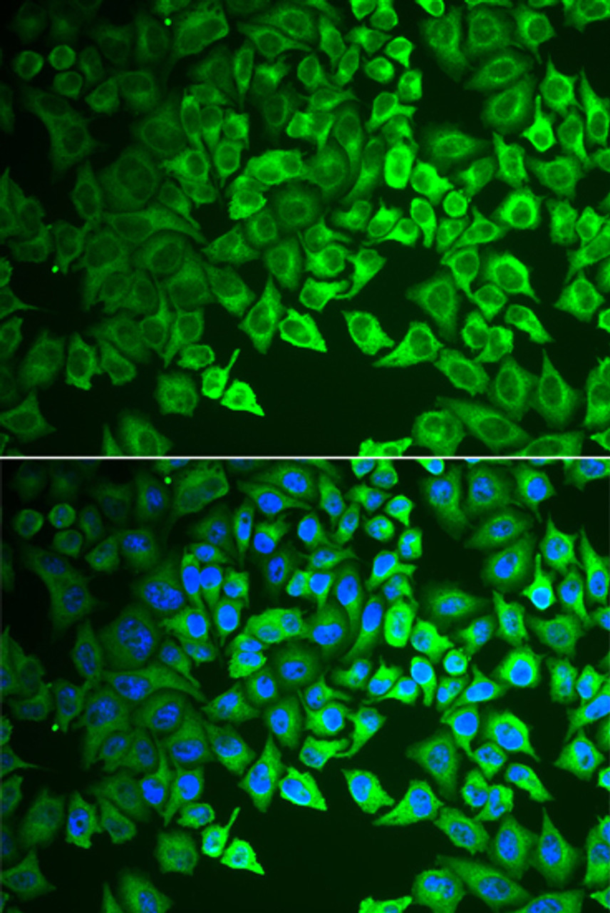 Immunofluorescence analysis of A549 cells using GIF Polyclonal Antibody