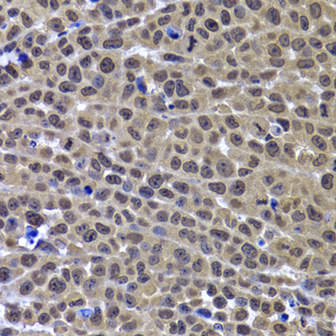Immunohistochemistry of paraffin-embedded Mouse cancer using GPS1 Polyclonal Antibody at dilution of  1:100 (40x lens).