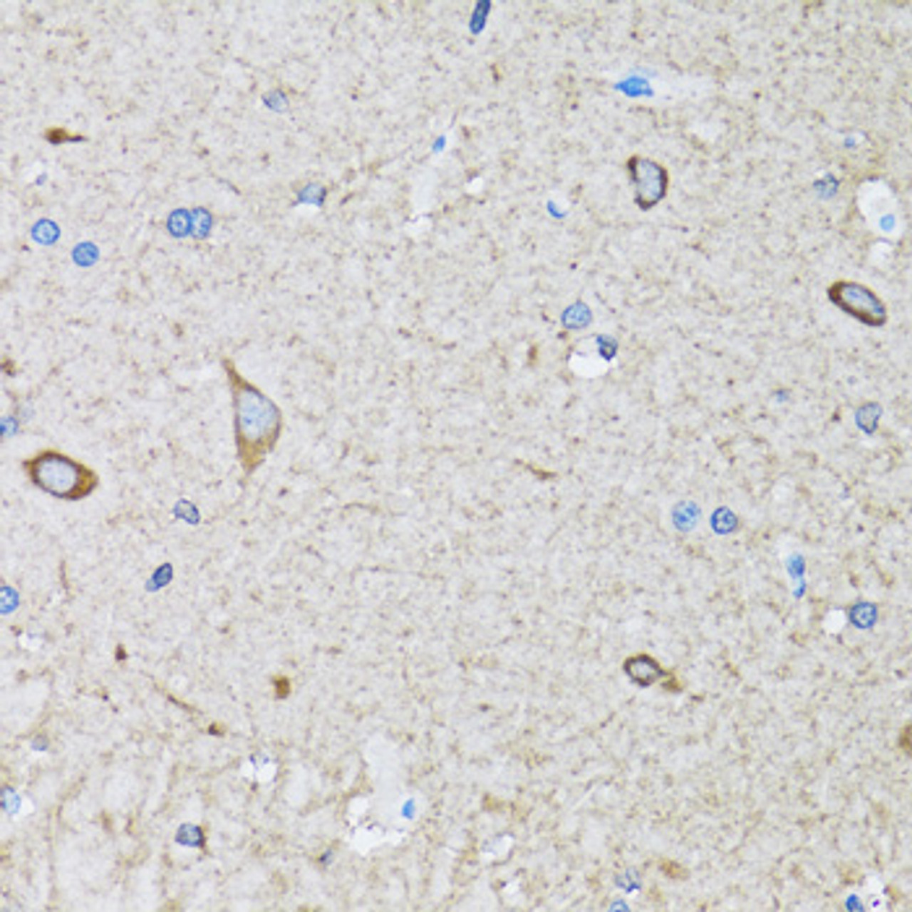 Immunohistochemistry of paraffin-embedded Mouse brain using HIP1 Polyclonal Antibody at dilution of  1:100 (40x lens).