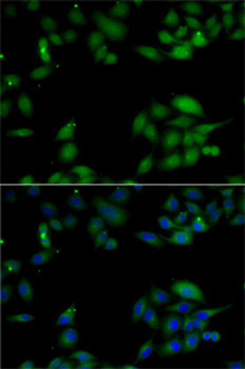 Immunofluorescence analysis of MCF7 cells using HIP1 Polyclonal Antibody