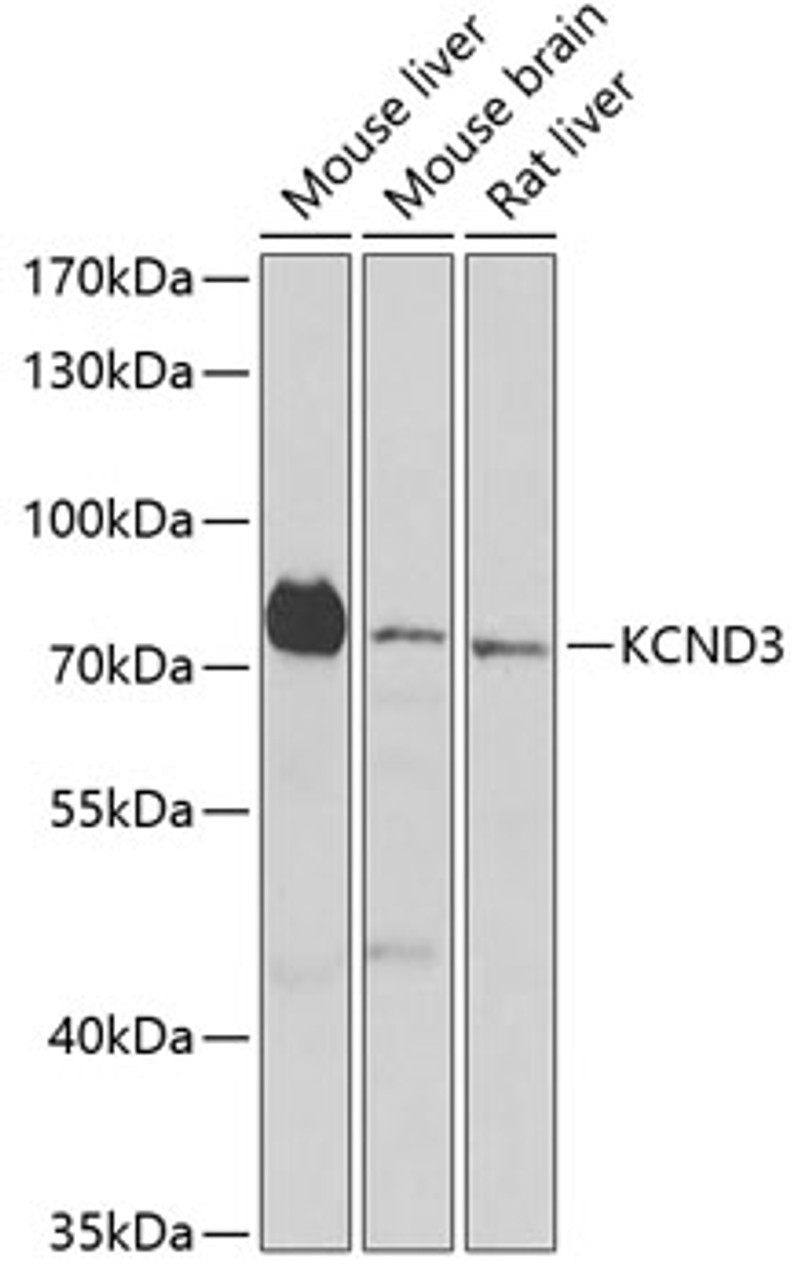 Western blot analysis of extracts of various cell lines using KCND3 Polyclonal Antibody at dilution of 1:1000.
