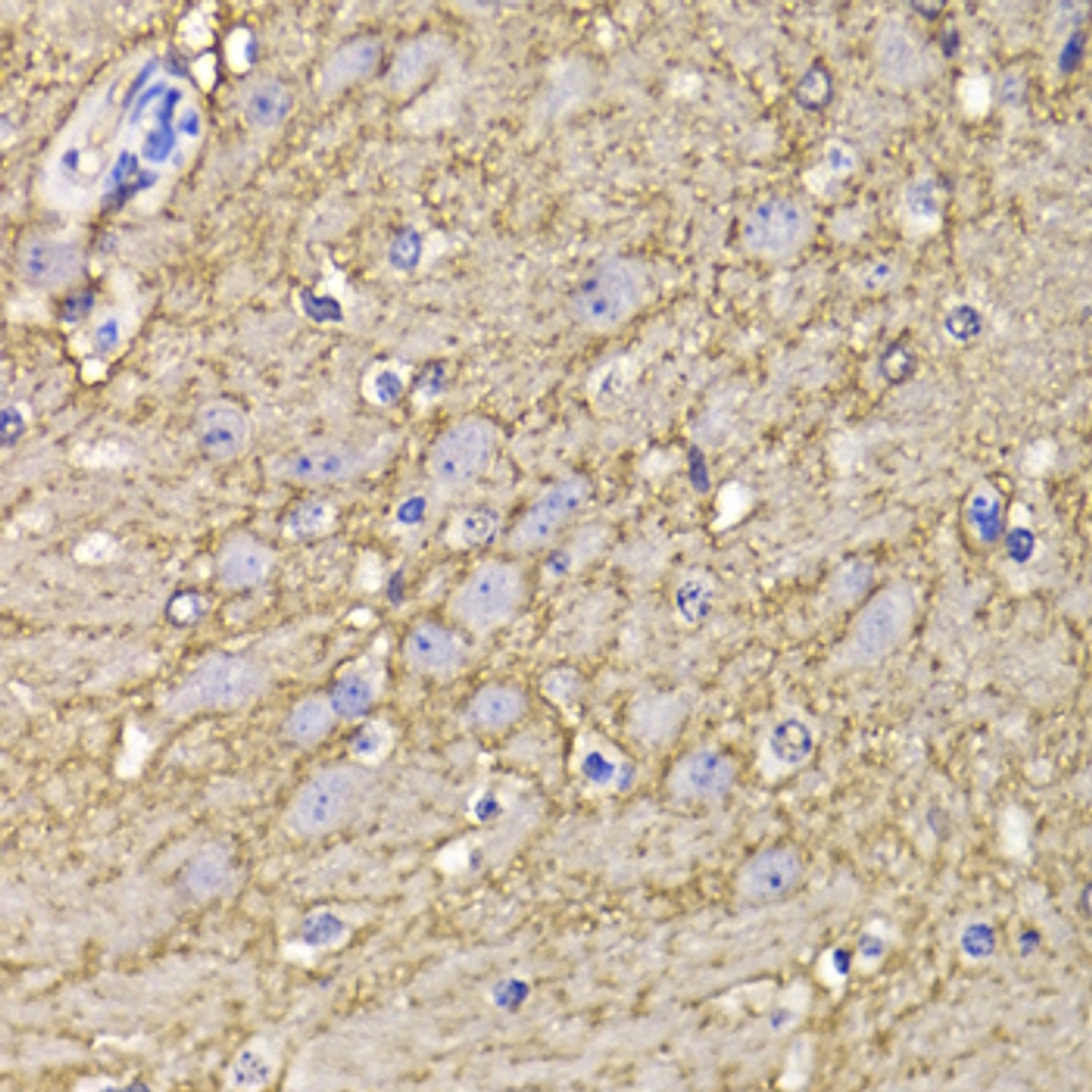 Immunohistochemistry of paraffin-embedded Mouse brain using KCND3 Polyclonal Antibody at dilution of  1:100 (40x lens).