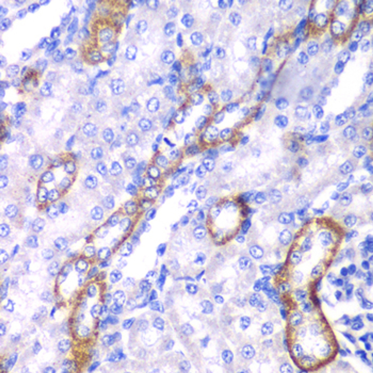 Immunohistochemistry of paraffin-embedded Rat kidney using MYO1C Polyclonal Antibody at dilution of  1:100 (40x lens).